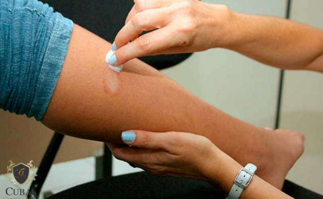 TRF1-  Concede pens�o especial a paciente de Hansen�ase